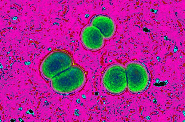 Meningitis-outbreak-caused-by-rare-fungus-spreads-quickly-affecting-brainstem